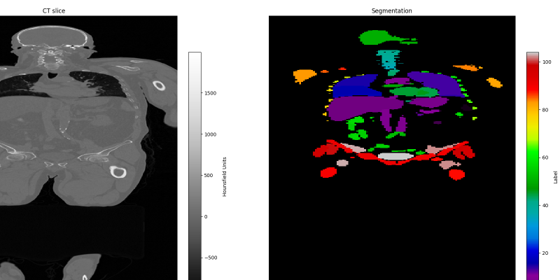 CT/MRI visualizer cover art